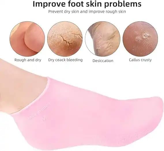 Moisturizing Silicone Spa Gel Socks – Dry & Cracked Feet