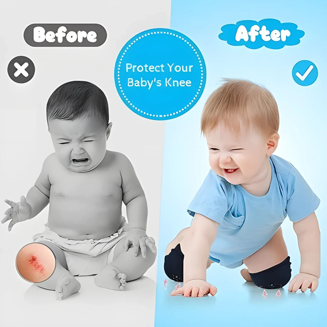 Baby Knee Pads – Crawling & Toddler Anti-Slip Guard